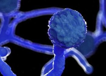 In Oman, fungal infection detected in some Covid patients