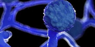 In Oman, fungal infection detected in some Covid patients 1 - Egyptian Gazette In Oman, fungal infection detected in some Covid patients