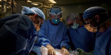 US surgeons successfully test pig kidney transplant in human patient 1 - Egyptian Gazette US surgeons successfully test pig kidney transplant in human patient