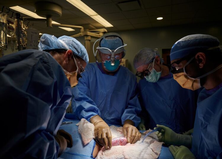 The surgical team examines the pig kidney for any signs of hyperacute rejection, as the organ was implanted outside the body to allow for observation and tissue sampling during the 54-hour study period, at NYU Langone in New York, US.