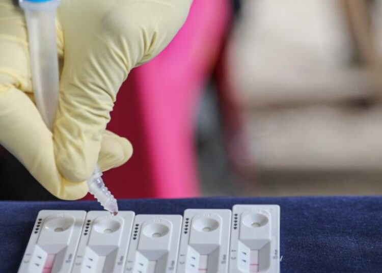 Nearly 11.75m confirmed cases of Covid-19 across Africa 2 - Egyptian Gazette Nearly 11.75m confirmed cases of Covid-19 across Africa 1 - Egyptian Gazette