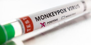 Japan’s 1st case of monkeypox confirmed: gov’t source
