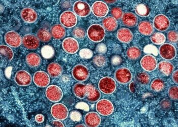 US confirms 1st death from monkeypox in California