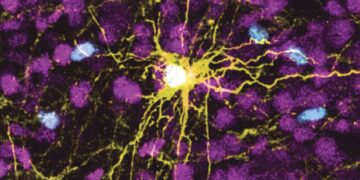 Scientists grow human brain cells in rats to study diseases 1 - Egyptian Gazette Scientists grow human brain cells in rats to study diseases