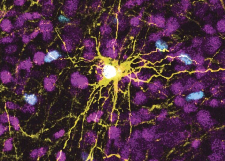This microscope image provided by Pasca Lab/Stanford Medicine shows a human astrocyte cell, center in yellow, and human glial cells (scattered in blue) inside the brain of a rat.