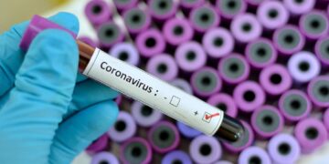 ’Egypt records slight increase in coronavirus cases’