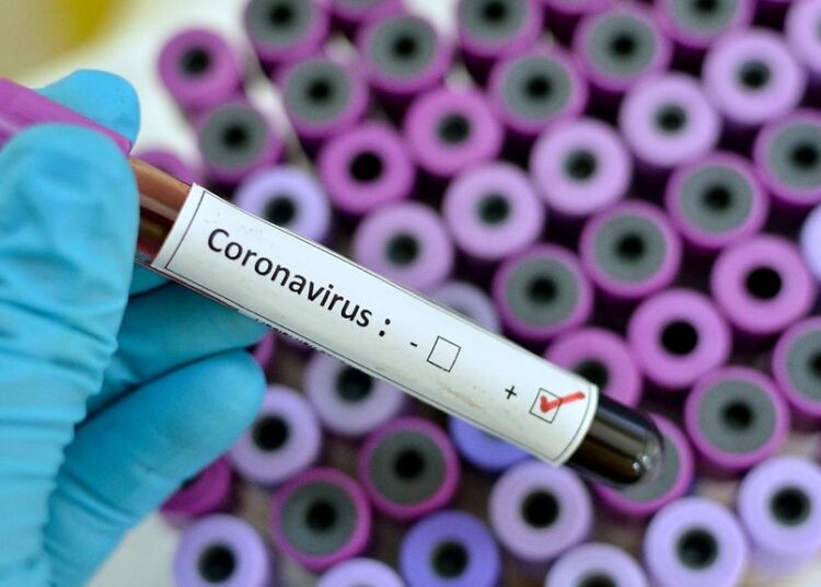 ’Egypt records slight increase in coronavirus cases’ 1 - Egyptian Gazette
