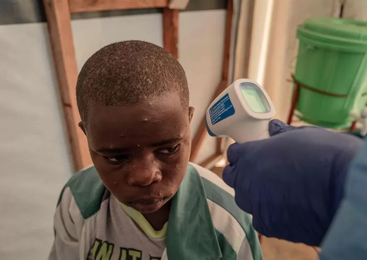 WHO: Mpox not to lead to int'l lockdown 2 - Egyptian Gazette WHO: Mpox not to lead to int'l lockdown 1 - Egyptian Gazette