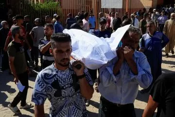 UN finds rising child malnutrition in Gaza 2 - Egyptian Gazette UN finds rising child malnutrition in Gaza 1 - Egyptian Gazette