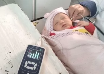 Egypt screens over 9.5m newborns for hearing impairment