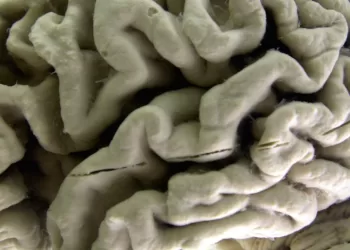 Study shows a blood test can help identify healthy people at high risk for Alzheimer’s disease