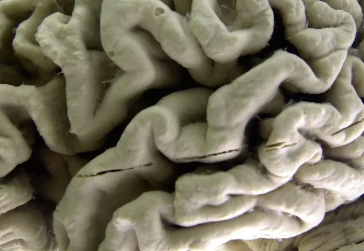 Study shows a blood test can help identify healthy people at high risk for Alzheimer’s disease 12 - Egyptian Gazette