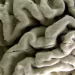 Study shows a blood test can help identify healthy people at high risk for Alzheimer’s disease
