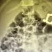 Egyptian child survives swallowing 20 batteries, magnets