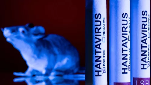 Hantavirus found in French tourist isolated in Spain 11 - Egyptian Gazette Hantavirus found in French tourist isolated in Spain 10 - Egyptian Gazette