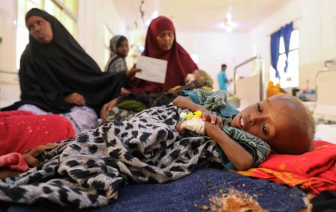 MSF: Half of displaced Somali children acutely malnourished 13 - Egyptian Gazette MSF: Half of displaced Somali children acutely malnourished 12 - Egyptian Gazette