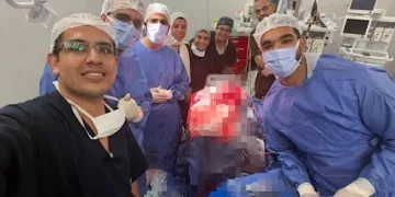 Egyptian surgeons remove metal nail from man’s skull